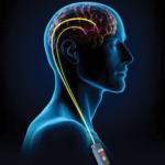 Estimulação Cerebral Profunda é um procedimento cirúrgico indicado para o tratamento de principalmente nos distúrbios do movimento. Dr Eduardo Urbano